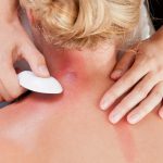 Gua Sha Scaping